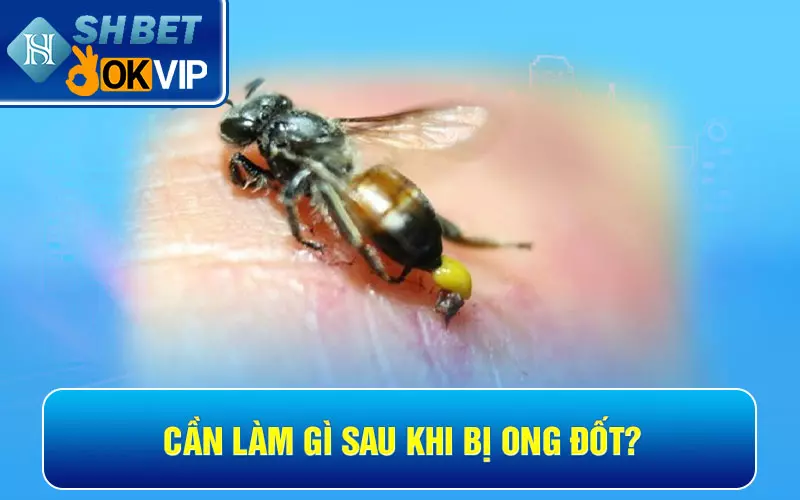 Cần làm gì sau khi bị ong đốt?