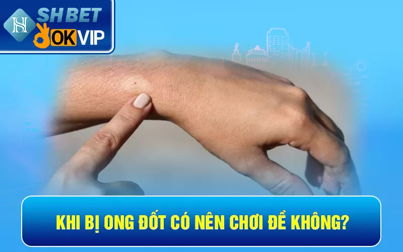 Khi bị ong đốt có nên chơi đề không?